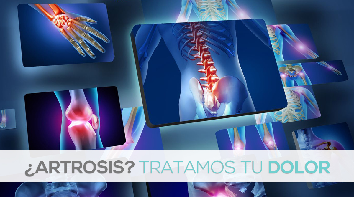 fisioterapia-traumatologo-vigo-tratamiento-artrosis