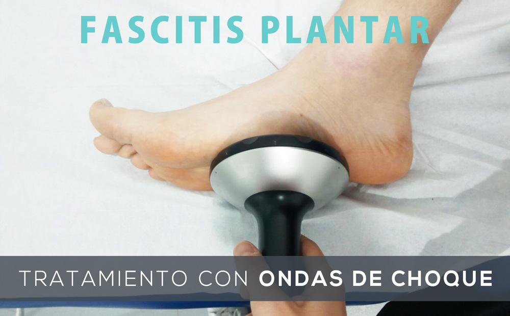 tratamiento-ondas-de-choque-fascitis-plantar-vigo-banner