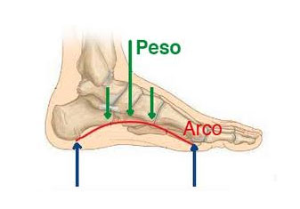 La fascitis plantar en atletas: causas, síntomas y tratamiento