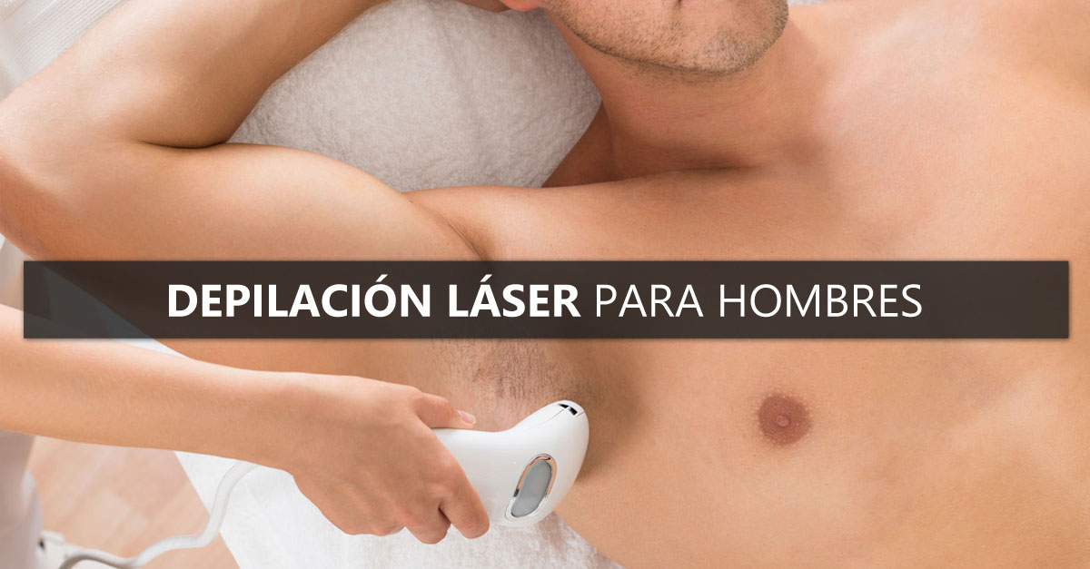 depilacion-laser-para-hombres-en-vigo