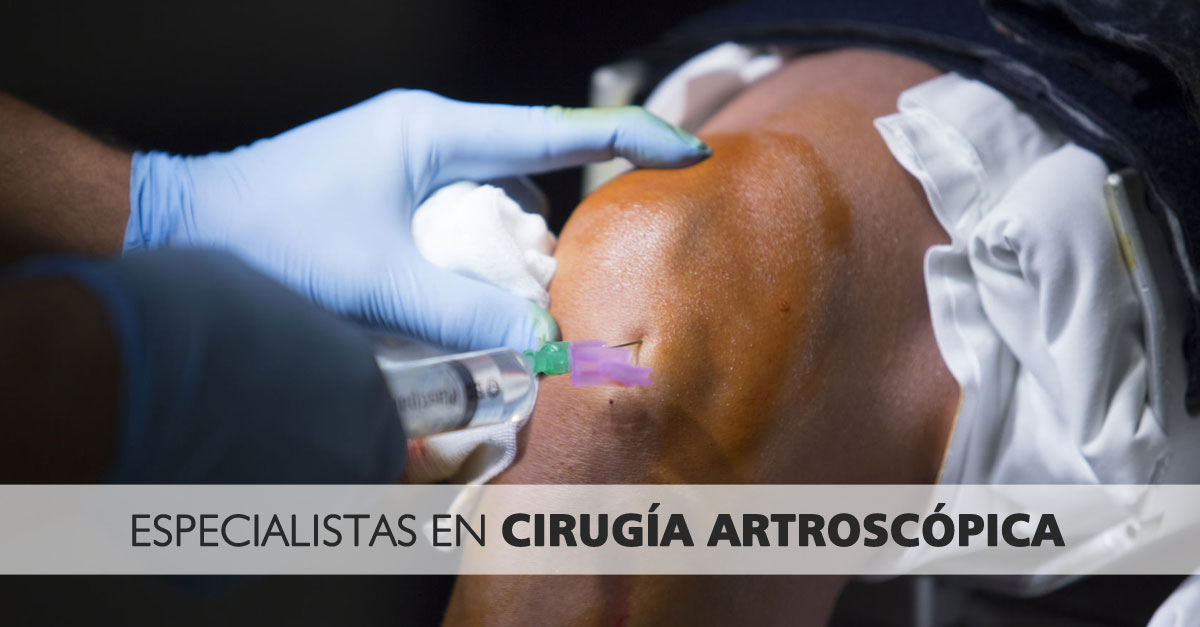 Especialistas en cirugía artroscópica Vigo