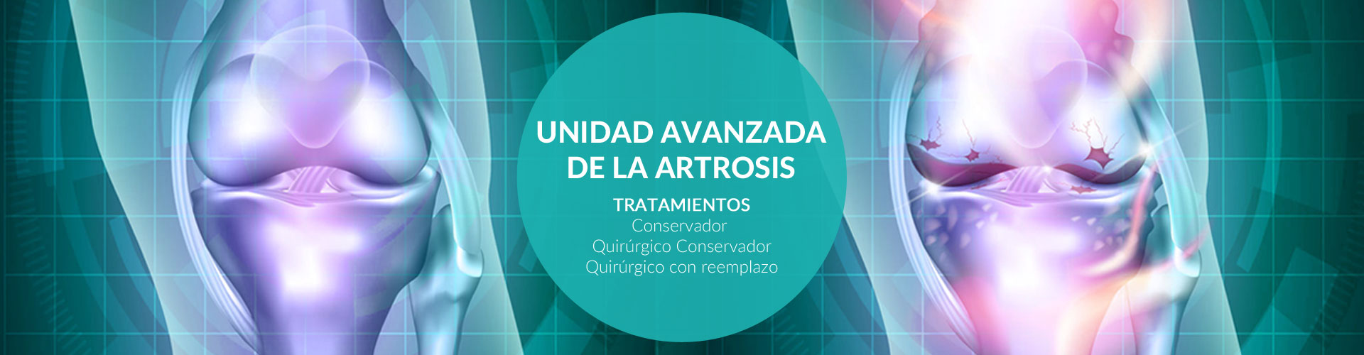 tratamientos-avanzados-de-la-artrosis