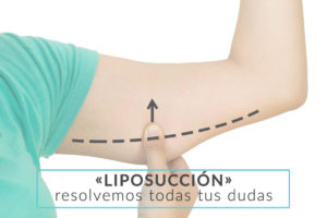 cirujano-plastico-liposuccion-vigo