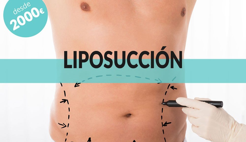 oferta-cirujano-plastico-liposuccion-vigo