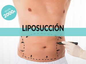 oferta-cirujano-plastico-liposuccion-vigo