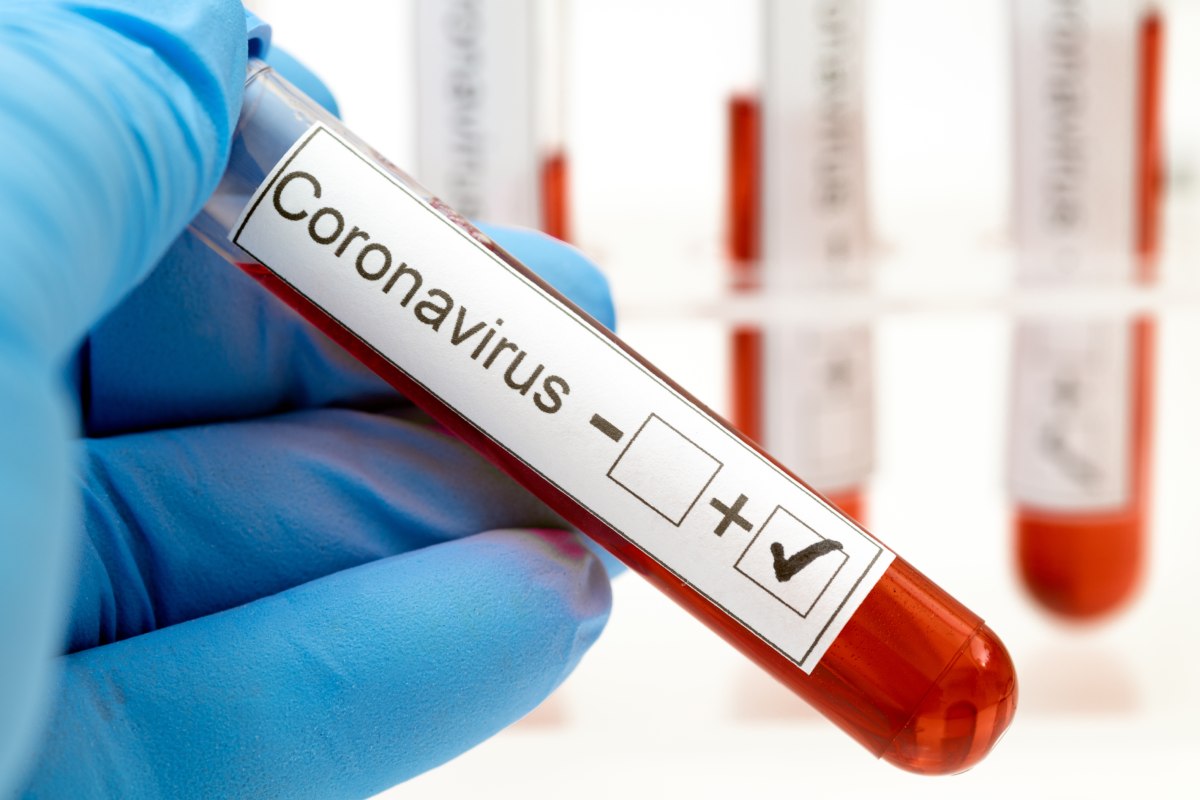 Test detección de Coronavirus en Vigo. Análisis para COVID-19 | ICONICA  Servicios Médicos