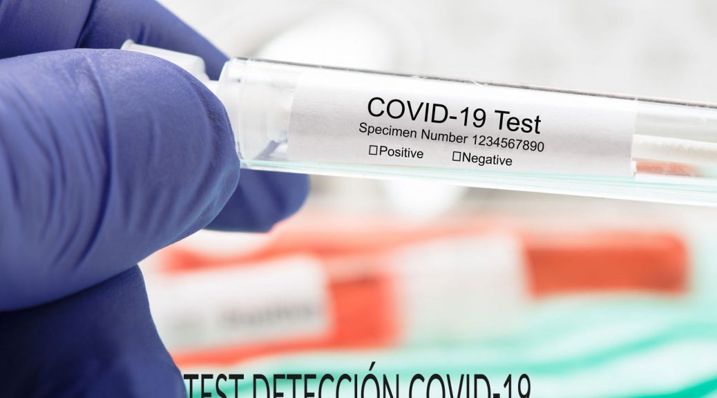 est-diagnostico-covid-19-pcr-deteccion-anticuerpos-vigo