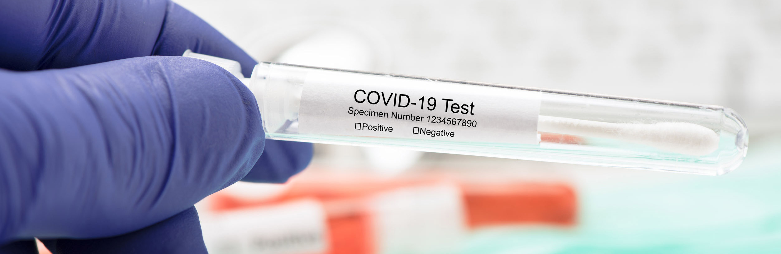 test diagnostico covid 19 Vigo