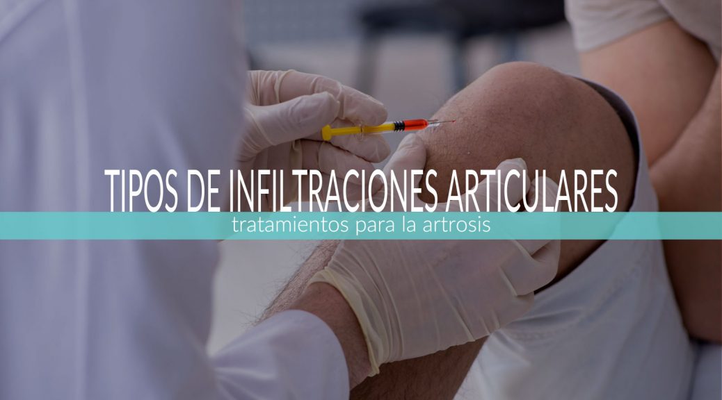 infiltracion-de-rodilla-para-la-artrosis