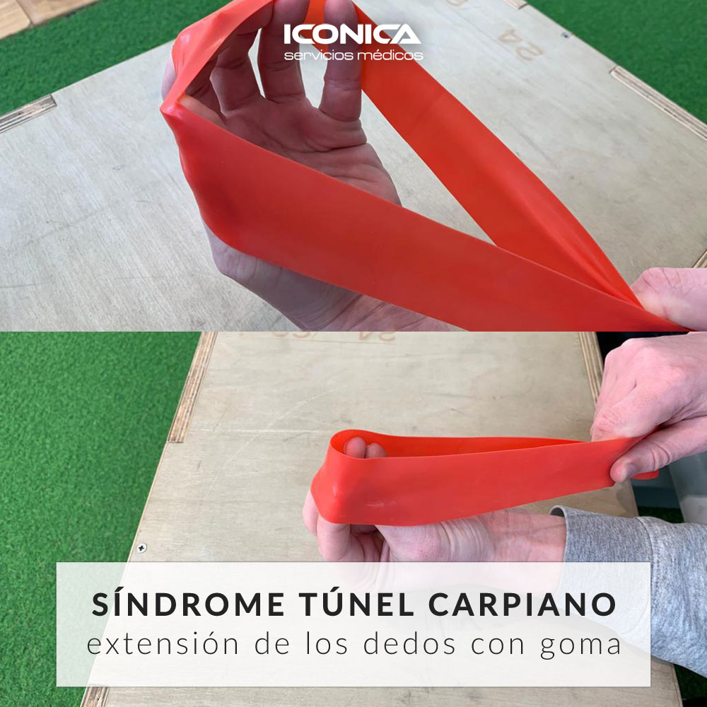 Ejercicios para síndrome TUNEL CARPIANO 