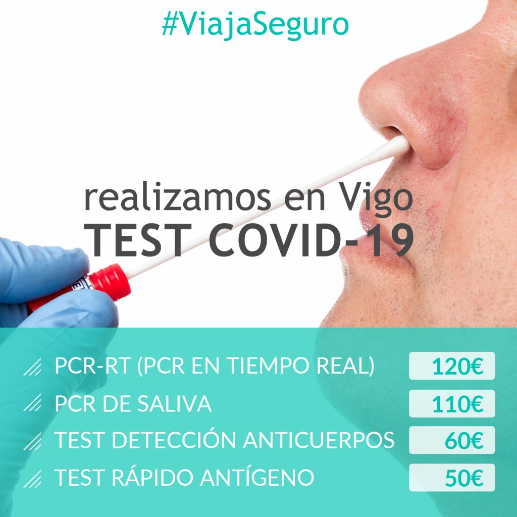 test-deteccion-covid-19-vigo-PCR-y-anticuerpos-para-viajar