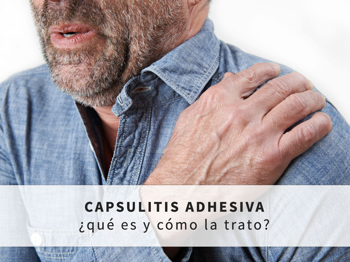 tratamiento-de-la-capsulitis-adhesiva