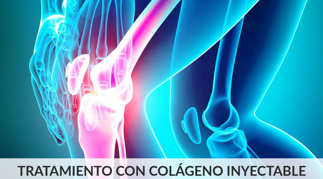 tratamiento-con-colageno-inyectable6