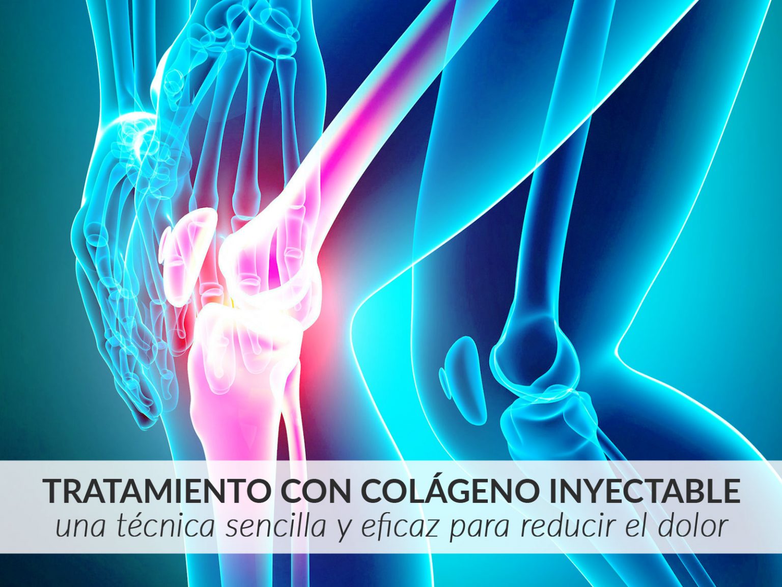 tratamientos-con-colageno-inyectable | ICONICA Servicios Médicos