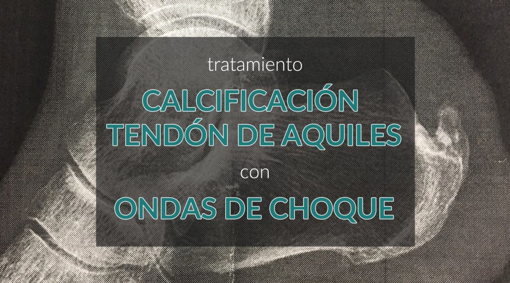 perturbación Maduro Hacer Tratamiento calcificación tendón de aquiles con ondas de choque | ICONICA  Servicios Médicos