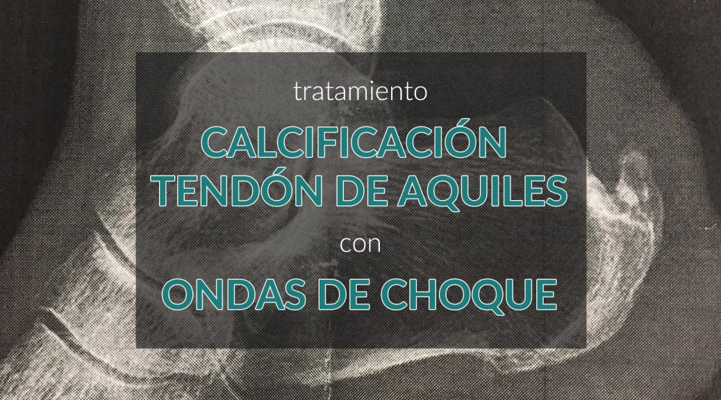 tratamiento-calcificacion-tendon-de-aquiles-con-ondas-de-choque