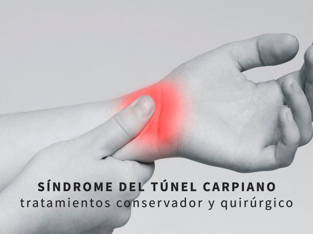 tratamiento-del-sindrome-del-tunel-carpiano-F