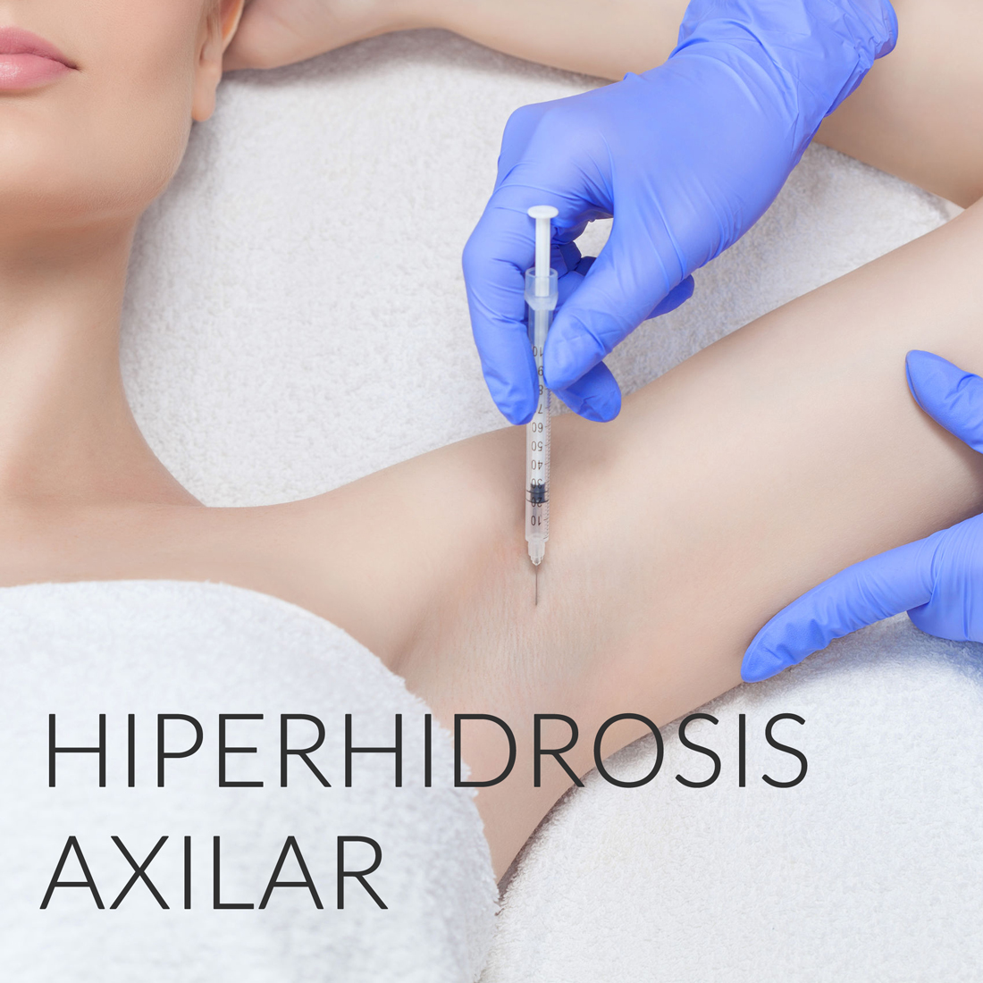 Tratamiento de la hiprhidrosis axilar