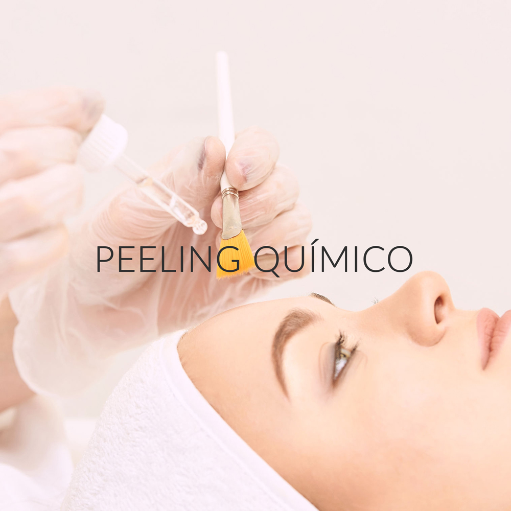 peeling quimico clinica medicina estética facial en vigo